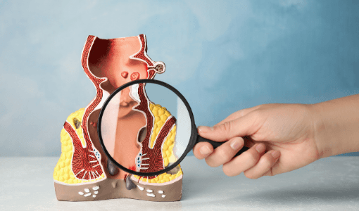 Best Piles, Fissure & Fistula Hospital Aundh