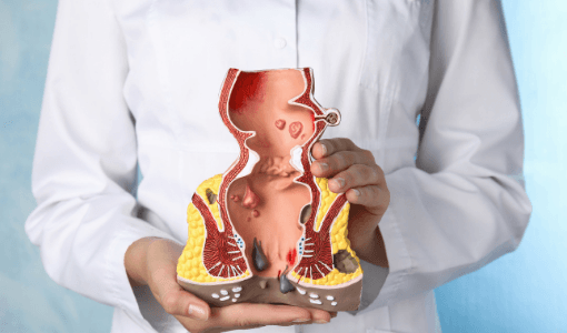 Best Piles, Fissure & Fistula Hospital Aundh